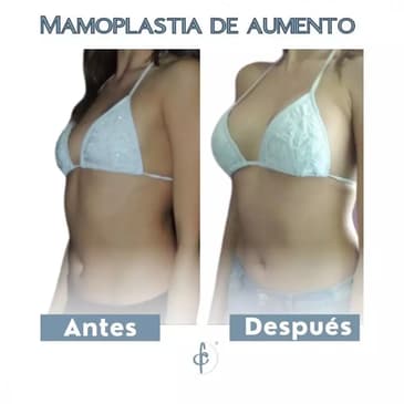 Slider image (2) Dr. Felipe Castro Esguerra - Plastic Surgeon in Colombia